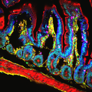 Dalton © Hugues Lelouard, Mailfert Sébastien & Mathieu Fallet CIML CNRS-INSERM-AMU
