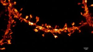 © Patrice MASCALCHI – IINS, UMS3420 CNRS - University of Bordeaux, US4 INSERM - Bordeaux Imaging Center