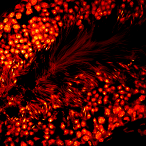 © Noushin Mossadegh & Mailfert Sébastien - CIML, CNRS-INSERM-AMU