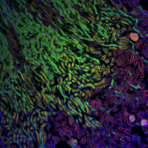 © Mailfert Sébastien – CIML, CNRS-INSERM-AMU