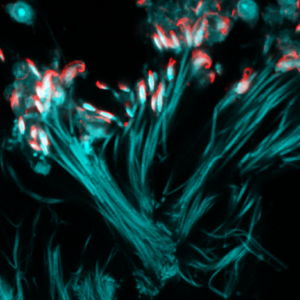© Noushin Mossadegh & Mailfert Sébastien - CIML, CNRS-INSERM-AMU