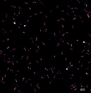 © Patrice MASCALCHI – IINS, UMS3420 CNRS - University of Bordeaux, US4 INSERM - Bordeaux Imaging Center
