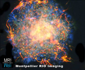 Lionel Simmonneau, INM - Neurosphère