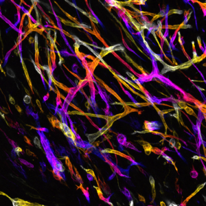 Tumour of Fire © Marcello Delfini & Mathieu Fallet - CIML CNRS-INSERM-AMU