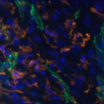 Nanoparticles in brain tumor vessels © Françoise Geffroy, CEA-DRF-NeuroSpin-UNIRS, Midas Team