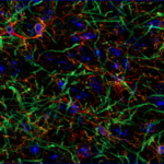 Glial cells in rat brain © Françoise Geffroy, CEA-DRF-NeuroSpin-UNIRS, Midas Team