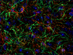 Glial cells in rat brain © Françoise Geffroy, CEA-DRF-NeuroSpin-UNIRS, Midas Team