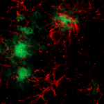 Microglia's attack! © Françoise Geffroy, CEA-DRF-NeuroSpin-UNIRS, Midas Team