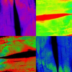 Warhol's Style SHG Muscle © Sébastien Marais, Bordeaux Imaging Center