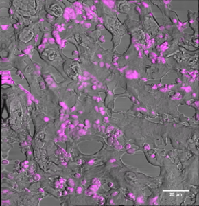 Cannot see the nanorods for the blood cells © Marie Held, Biochemistry, University of Liverpool, Levy Lab