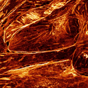 Actin fireworks© Patrice Mascalchi, Bordeaux Imaging Center and Frédéric Saltel, INSERM U-1053, University of Bordeaux