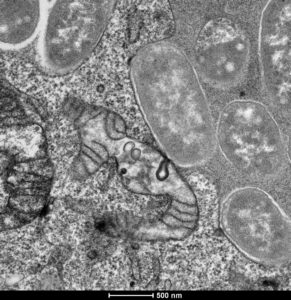 Transmission electron microscopy observation of cells infected with Yersinia pseudotuberculosis in order to see their intra-vacuolar localization.