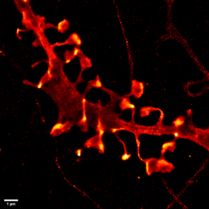 Rat hippocampal neuron filled with a fluorescent marker and observed by dSTORM. The image shows details of dendritric spine morphology as well as surrounding axons in which we can observe the membrane-associated periodic skeleton.