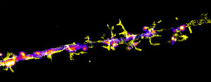 The image shows the movements of Dopamine Receptors at the surface of hippocampal neurons and was acquired on a spinning disk. We took 1000 frames at 50ms exposition before reconstructing the trajectories of single receptors with PalmTracer. This allow us to understand, down to the nanometric scale, how the interaction between receptors modulate their surface diffusion.