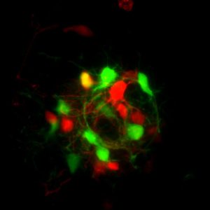 Neuronal spheroids of rat primary neurons are grown in hydrogel templates. The cells are electroporated with GFP and tdtomato. Then the spheroids are fixed and imaged with a confocal microscope. Cells in 3D structure mimic better functions and morphology properties of in vivo.