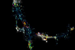 Representation of PALM technology on a rat hippocampal neuron. The low resolution image corresponds to the synaptic marker, Homer-GFP. Using PALM superresolution technology, it is possible to visualise NMDAR trafficking and clusters in high resolution. This approach can be used in the study of autoimmune neuropsychiatric diseases that disrupt both the organisation of NMDAR and their diffusion at the neuronal surface.