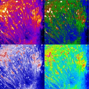 Patchwork of 4 maximum projections with different LUTs of a z-stack acquired in 2-photon microscopy. Neurons express the GCaMP6f calcium sensor following a viral infection of an organotypic mouse brain slice.