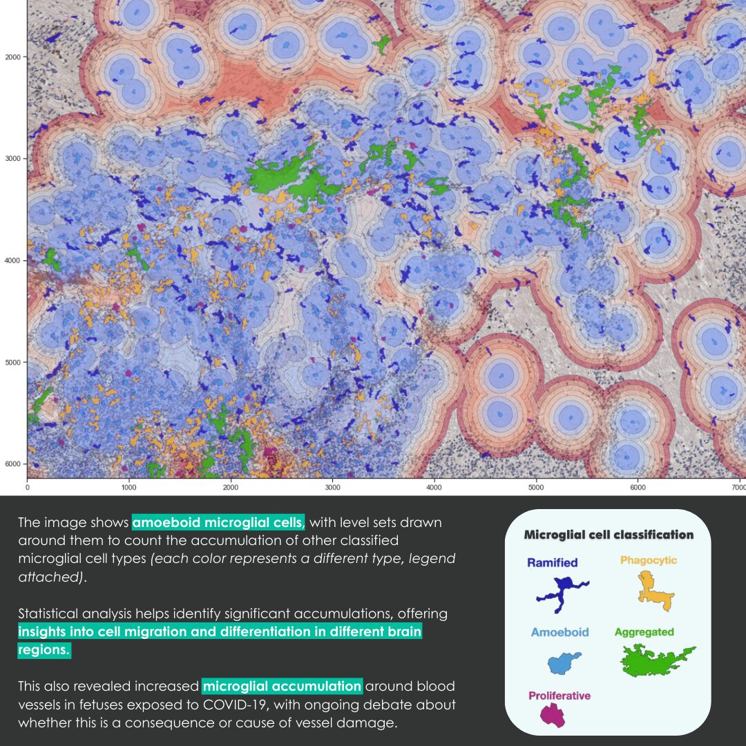 Better Understanding Brain Development Through AI – France-BioImaging